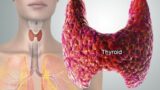 yoga for thyroid vitality